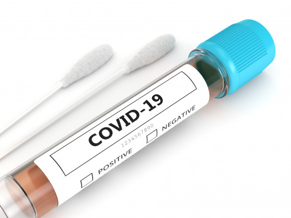 Тест на коронавирус 