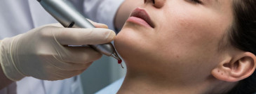 Ультразвуковая чистка лица