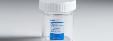 Анализ кала