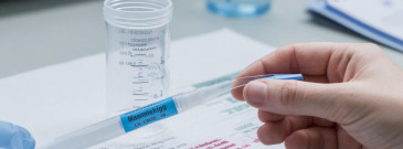 Мазок на онкоцитологию